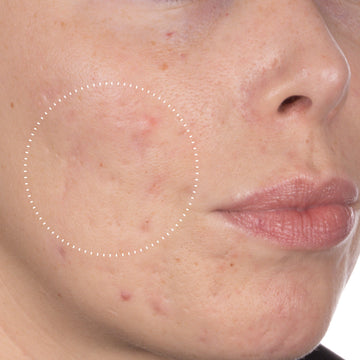 Niacinamide Peptides after 7 days