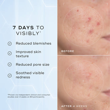 Niacinamide Peptides before and after 4 weeks, skin texture