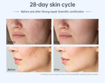 Dr. Pen A11 Microneedling Pen